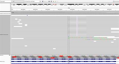 Efficacy of dabrafenib/trametinib in pancreatic ductal adenocarcinoma with BRAF NVTAP deletion: A case report